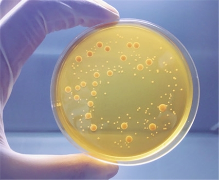 Agar Plates 